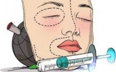 伊w兰注射隆鼻果怎么样?伊w兰注射隆鼻果好不好?