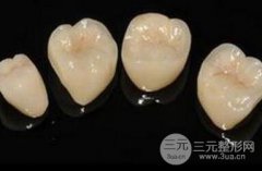 沈阳钴铬烤瓷牙价格，影响因素