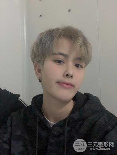 哈医大二院整形科肖志波割双眼皮对比图男性案例