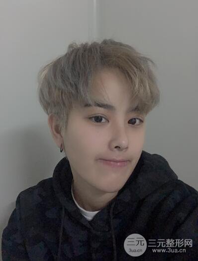 哈医大二院整形科肖志波割双眼皮对比图男性案例