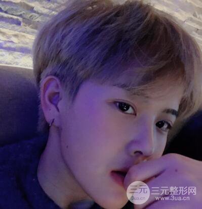 哈医大二院整形科肖志波割双眼皮对比图男性案例