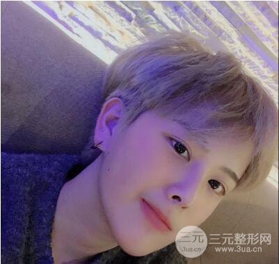 哈医大二院整形科肖志波割双眼皮对比图男性案例