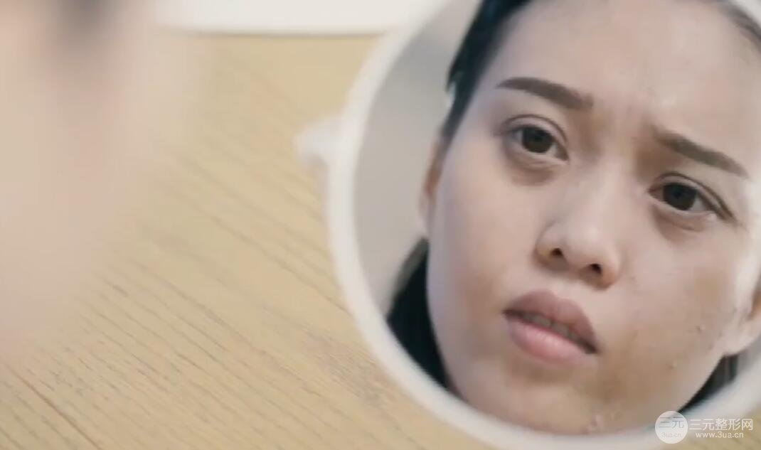 伊w兰除皱大概需要多少钱呢?