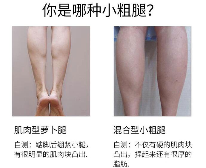 注射瘦腿成好吗?如何GETZ理想的瘦腿果?