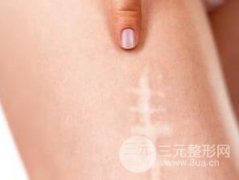 注射祛疤的疗程多久见