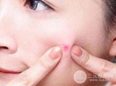 红蓝光祛痘价格是多少？贵不贵？