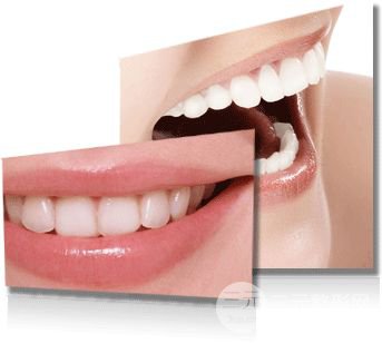 烤瓷牙的材料有哪些 烤瓷牙自然吗？