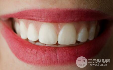 烤瓷牙的材料有哪些 烤瓷牙自然吗？