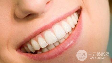 什么烤瓷牙果喜欢 装烤瓷牙好吗