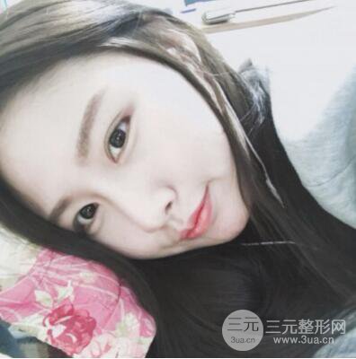 西安叶子鲁礼新埋线双眼皮案例对照图!两个月恢复心情小记