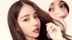 隆鼻能保持多久 是永.久的吗? 隆鼻能保持多久 是永.久的吗?