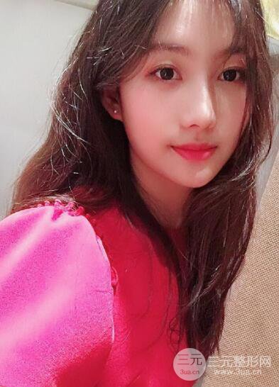 苏州紫馨孙影塌鼻子假体隆鼻案例对比照心情小札