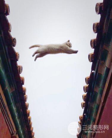 苏州紫馨孙影塌鼻子假体隆鼻案例对比照心情小札