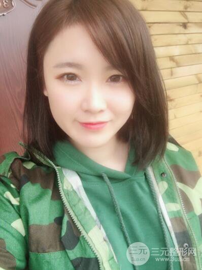 贵阳美莱梁洁芭比媚双眼皮多项整形前后对比图恢复心情小札