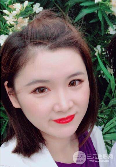 贵阳美莱梁洁芭比媚双眼皮多项整形前后对比图恢复心情小札