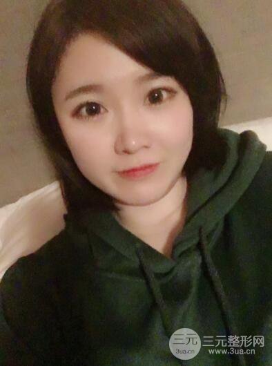 贵阳美莱梁洁芭比媚双眼皮多项整形前后对比图恢复心情小札