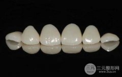 装个烤瓷牙多少钱，影响价格的因素有哪些？