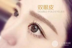三点定位割双眼皮图片