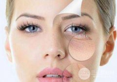 内吸去眼袋能保持几年?内吸祛眼袋的果维持时间?