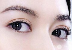 三点定位双眼皮的优缺点有哪些