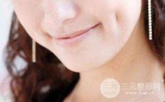 做酒窝手术怎么样?价格贵吗?