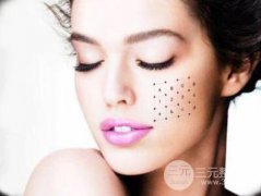 电波l皮多少钱 价格影响因素有哪些 电波l皮多少钱 价格影响因素有哪些