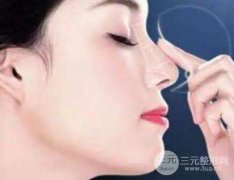 耳软骨隆鼻手术费用?耳软骨隆鼻手术多少钱? 耳软骨隆鼻手术费用?耳软骨隆鼻手术多少钱?