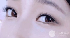 割双眼皮已经一年了 为什么还能被看出来？
