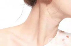 颈纹怎么消除？有哪些去颈皱方案？