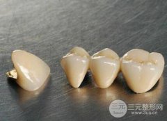 烤瓷牙可以用多少年?