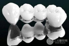 烤瓷牙种类及价格?