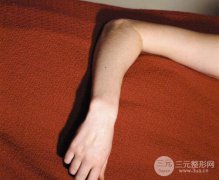 手臂激光脱毛多少钱？各个城市的价格一样吗？