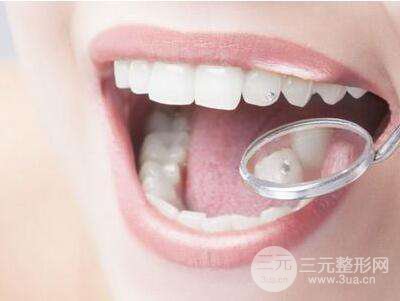 我们为什么要做牙齿矫正?牙齿矫正有什么好处?
