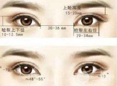 双眼皮手术的原理?哪些人适合什么样的手术方法?
