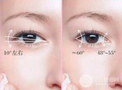 成都开眼角需要多少钱?价格受哪些因素影响?
