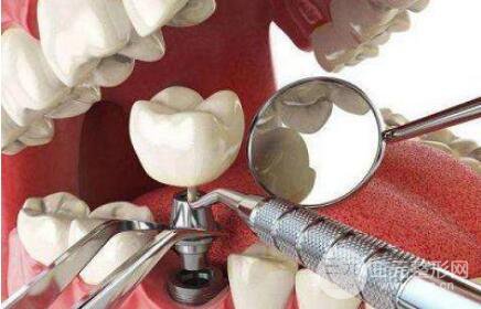 北京好的种植牙手术多少钱