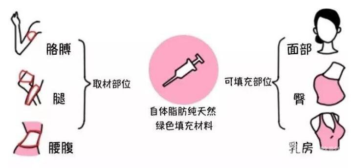自体脂肪填充好吗?果怎么样?