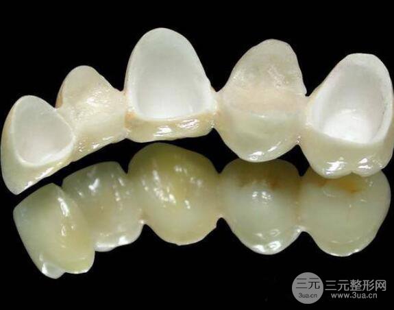 纯钛烤瓷牙价格
