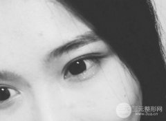 成都做双眼皮多少钱？手术后要注意些什么