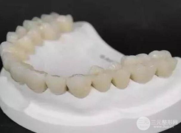 北京烤瓷牙价格多少?有什么副作用吗?