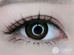 男生割双眼皮要多少钱