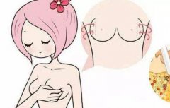 副乳切除手术几天恢复?副乳切除手术恢复时间? 副乳切除手术几天恢复?副乳切除手术恢复时间?