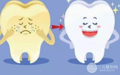 洗牙多少钱一次?洗牙多少钱?