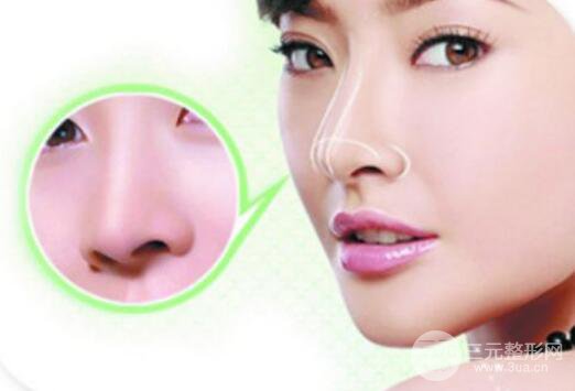 自体隆鼻果图