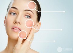 镭射激光美容收费多少钱？价格贵不贵呢？