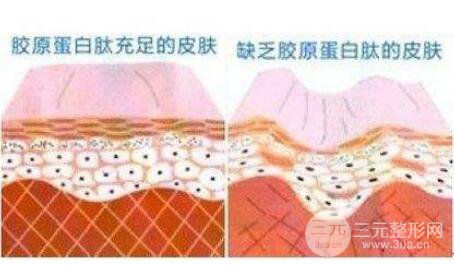 胶原蛋白针多少钱一只?