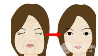 电波l皮拉皮一次多少钱?价格受哪些因素影响?