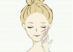 下颌角切除多久恢复?如何做好护理工作?