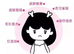 光子嫩肤护理应该怎么做?如何做好护理工作?