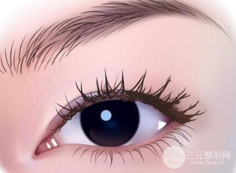 拉双眼皮手术恢复时间多久?怎么加快恢复?